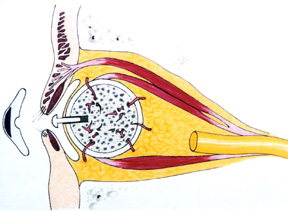 义眼片运动的基本原理